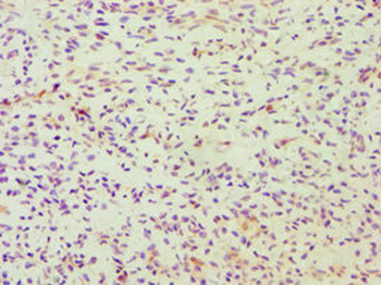 DDX5 Antibody