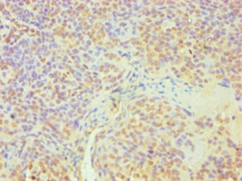 DDX5 Antibody