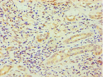 DDX5 Antibody