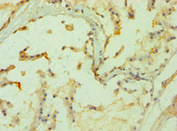PPP3CC Antibody