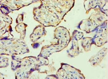PPP3CC Antibody
