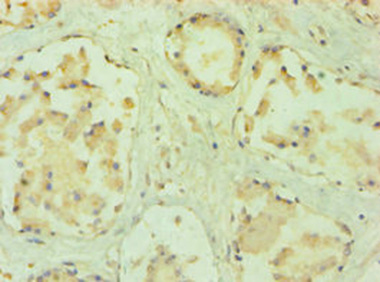 PPP3CC Antibody