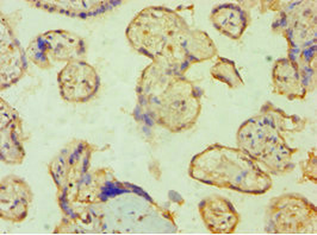 PPP3CC Antibody
