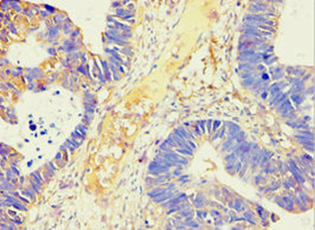 AMY2B Antibody