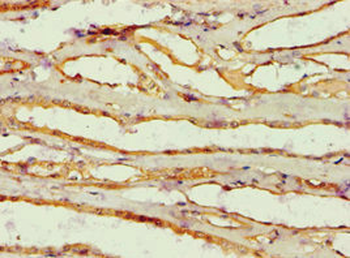 AMY2B Antibody