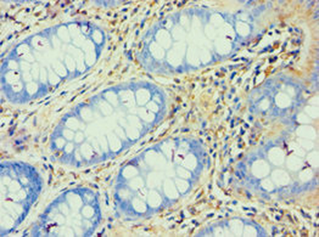 ATP5F1 Antibody