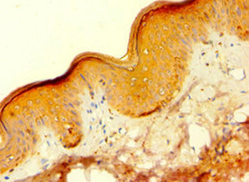 HAUS4 Antibody