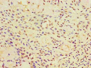 CALR3 Antibody