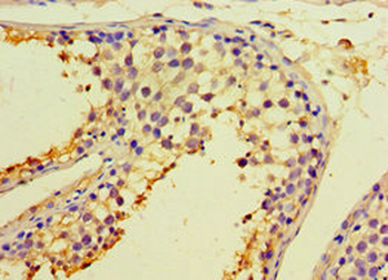 CALR3 Antibody