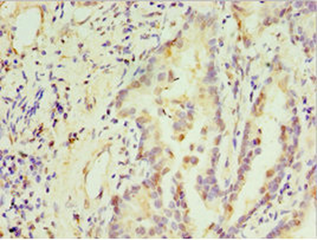 STX3 Antibody