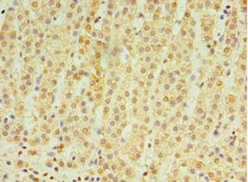 RNF212 Antibody
