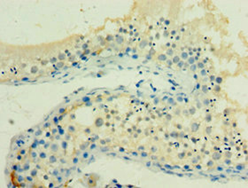 HSPA2 Antibody