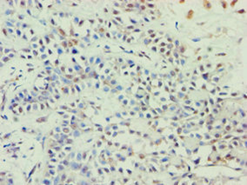 ABCE1 Antibody