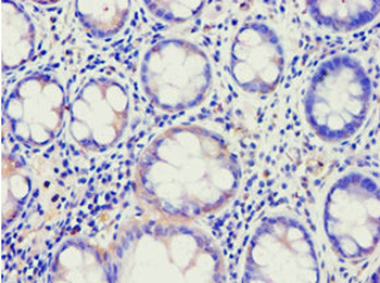 ABCE1 Antibody