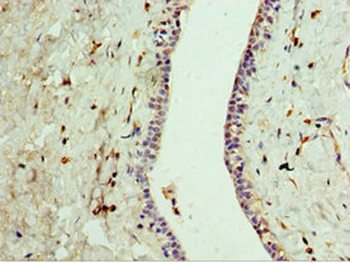 GPRC5A Antibody