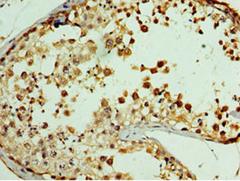GPRC5A Antibody