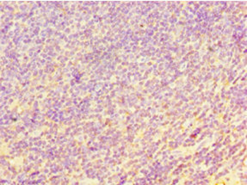 CHI3L2 Antibody