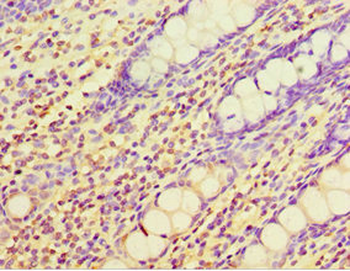 CHI3L2 Antibody