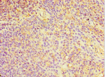 CHI3L2 Antibody