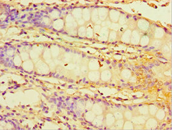 CHI3L2 Antibody