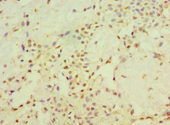 STARD3 Antibody