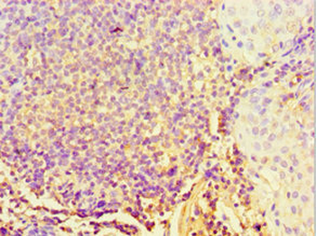 STARD3 Antibody