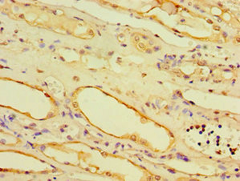 AHCYL1 Antibody