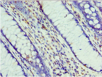PHB2 Antibody