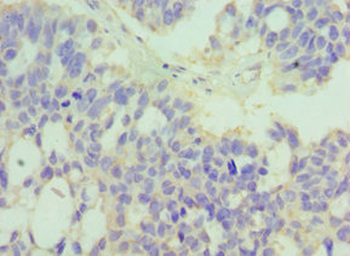 MERTK Antibody