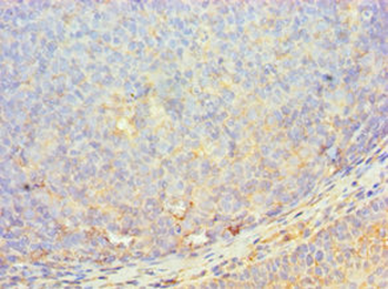 MERTK Antibody