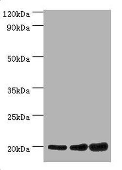 NAA20 Antibody