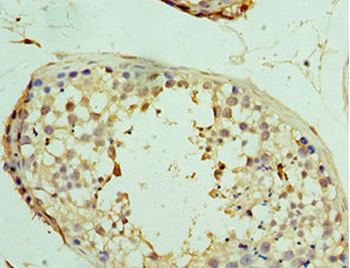 USP8 Antibody