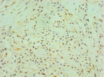 CTSK Antibody