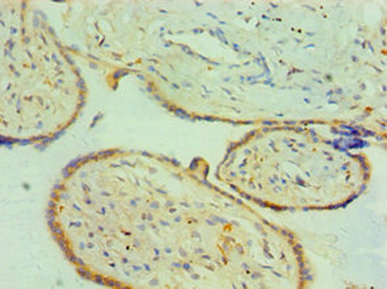 CTSK Antibody