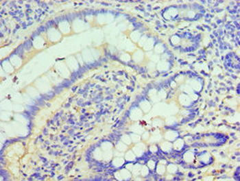 CLIC1 Antibody
