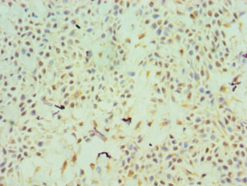 TFPI2 Antibody