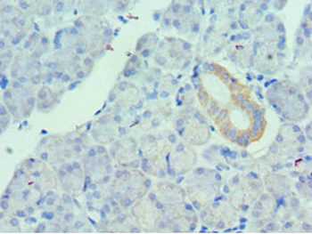 UTS2 Antibody