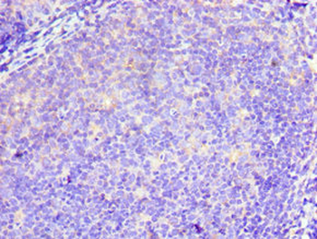 TWF2 Antibody