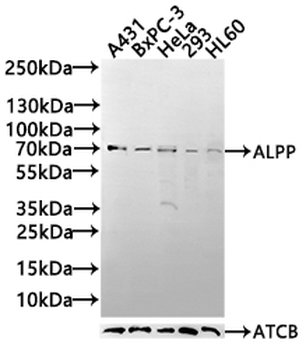 ALPP Antibody