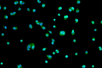 ALPP Antibody