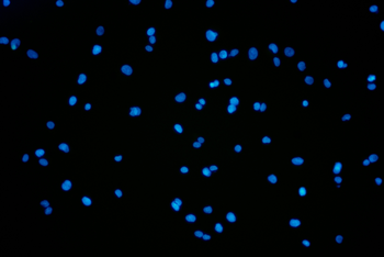 ALPP Antibody