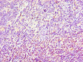 AKR1C4 Antibody