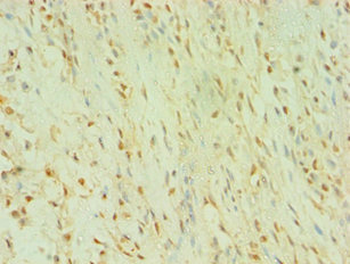 BLK Antibody