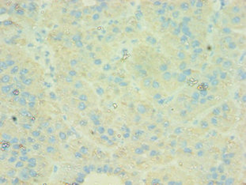 C4BPB Antibody