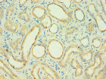 C4BPB Antibody
