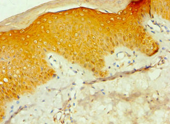 CSNK1A1L Antibody