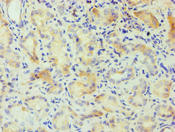 CSNK1A1L Antibody