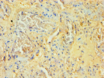 SOCS2 Antibody