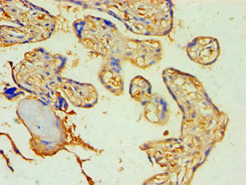 SOCS2 Antibody