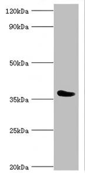 CD84 Antibody